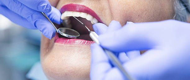 Best Emergency Root Canal Treatment in Garden Plain, KS