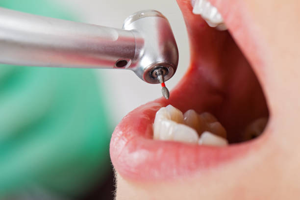 Best Emergency Dentist for Knocked-Out Tooth in Garden Plain, KS
